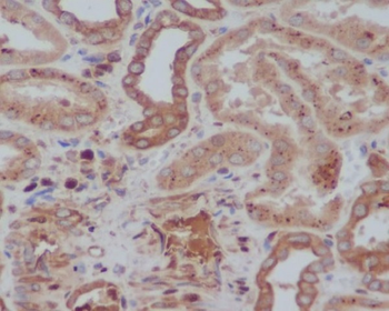 Tyrosine Hydroxylase Rabbit Monoclonal Antibody