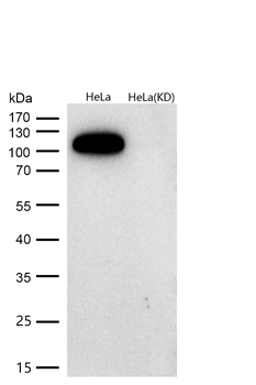 Hexokinase 1 Rabbit mAb [KD Validated] Antibody