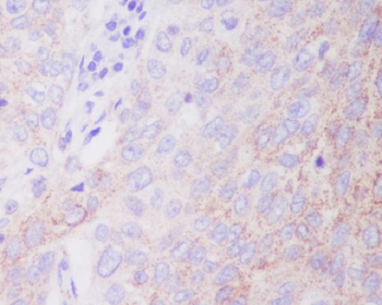 Hexokinase 1 Rabbit mAb [KD Validated] Antibody