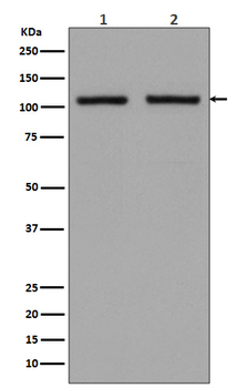 Hexokinase 1 Rabbit mAb [KD Validated] Antibody