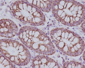 TOMM20 Rabbit Monoclonal Antibody