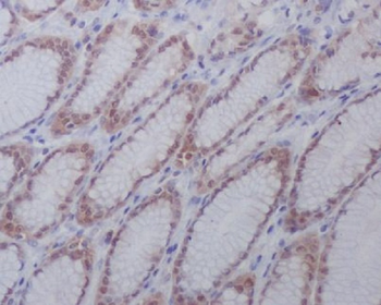 active + pro Caspase 3 Rabbit mAb [KD Validated] Antibody