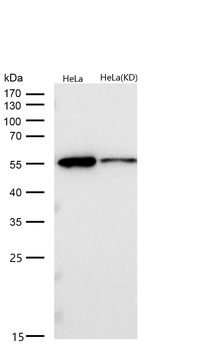 MLKL Rabbit mAb [KD Validated] Antibody