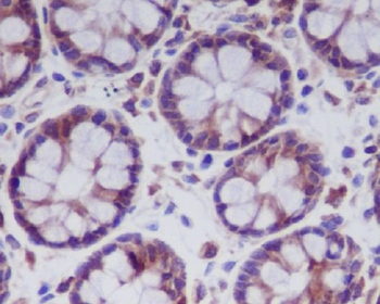 MLKL Rabbit mAb [KD Validated] Antibody