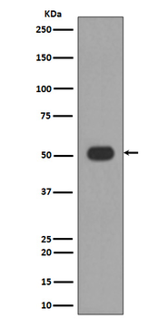 MLKL Rabbit mAb [KD Validated] Antibody