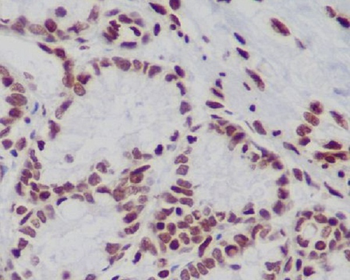 Histone H3 (mono+di+tri methyl K79) Rabbit mAb Antibody