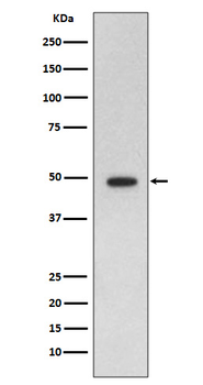 GFAP Rabbit mAb Antibody