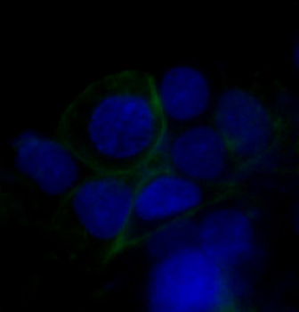GLUT1 Rabbit Monoclonal Antibody