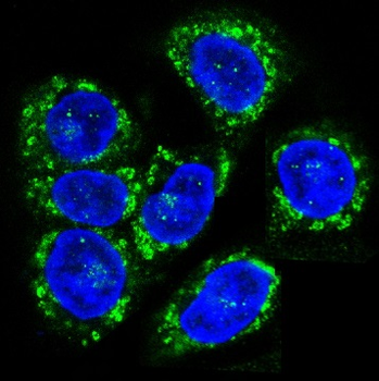 CCR7 Rabbit mAb Antibody