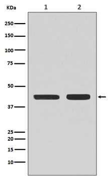 CCR7 Rabbit mAb Antibody