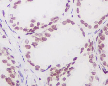 Androgen Receptor Rabbit mAb [KD Validated] Antibody