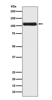 Androgen Receptor Rabbit mAb [KD Validated] Antibody