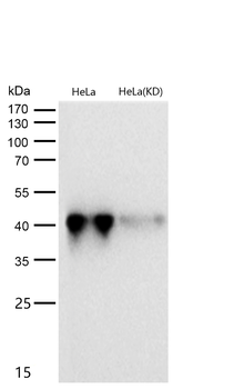 Glutamine Synthetase Rabbit mAb [KD Validated] Antibody