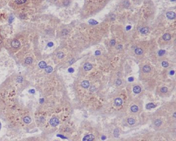 Glutamine Synthetase Rabbit mAb [KD Validated] Antibody