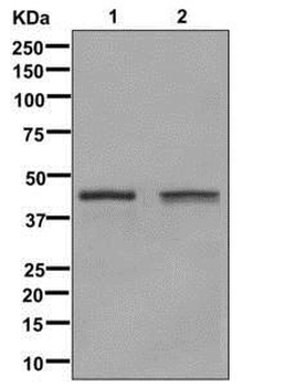 Glutamine Synthetase Rabbit mAb [KD Validated] Antibody