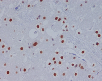 STAT3 Rabbit mAb [KD Validated] Antibody