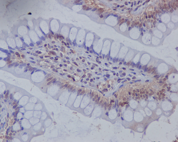 Musashi 1 Rabbit Monoclonal Antibody