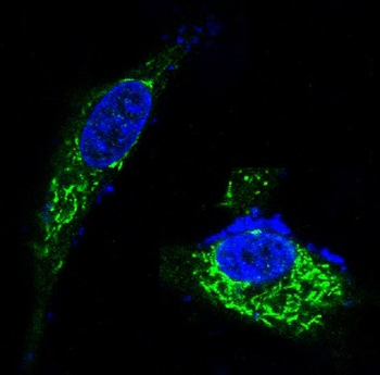 BDNF Rabbit mAb [KD Validated] Antibody