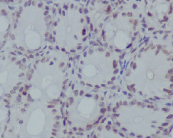 Histone H3 (mono methyl R17) Rabbit mAb Antibody