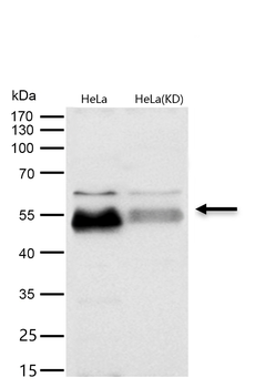 Smad5 Rabbit mAb [KD Validated] Antibody