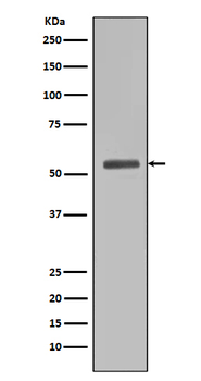 Smad5 Rabbit mAb [KD Validated] Antibody