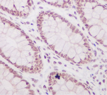 Histone H3 (acetyl K56) Rabbit mAb [KD Validated] Antibody