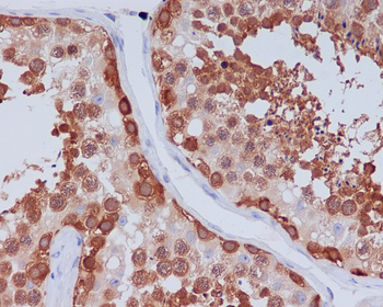 Hsp90 beta Rabbit mAb [KD Validated] Antibody