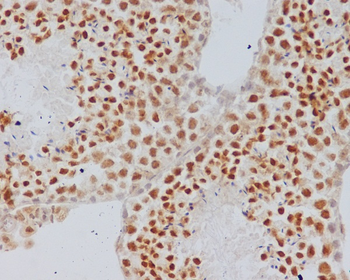 Alpha Synuclein Rabbit mAb Antibody