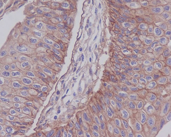 Integrin beta 1 Rabbit mAb [KD Validated] Antibody