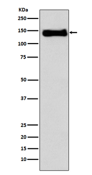 Integrin beta 1 Rabbit mAb [KD Validated] Antibody
