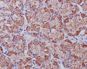 EGFR (ErbB 1) Rabbit mAb [KD Validated] Antibody