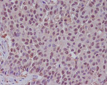 ERK1 Rabbit mAb [KD Validated] Antibody