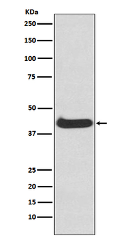 ERK1 Rabbit mAb [KD Validated] Antibody