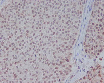 ERK1 Rabbit mAb [KD Validated] Antibody