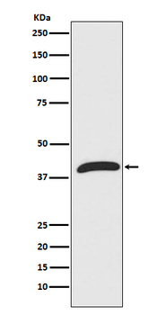 ERK1 Rabbit mAb [KD Validated] Antibody