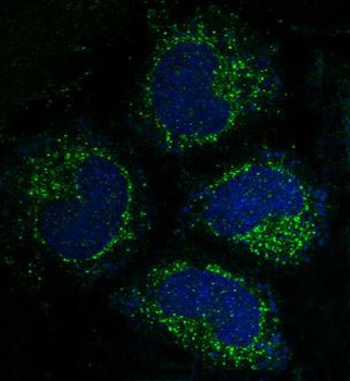 Caspase-3 Rabbit mAb [KD Validated] Antibody