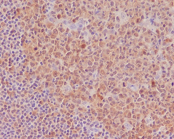 Caspase-3 Rabbit mAb [KD Validated] Antibody