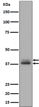 Phospho-Erk1 (T202/Y204) + Erk2 (T185/Y187) Rabbit mAb Antibody
