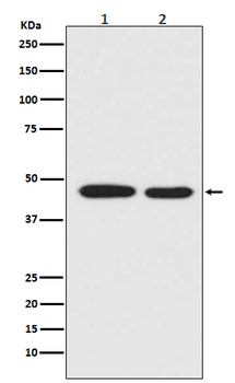 MEK1 Rabbit mAb Antibody