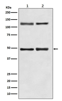 NF-κB (p105/p50) Rabbit mAb [KD Validated] Antibody