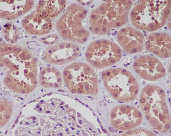 NF-κB (p105/p50) Rabbit mAb [KD Validated] Antibody