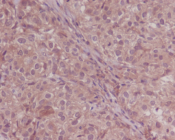Smad4 Rabbit mAb [KD Validated] Antibody