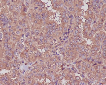beta III Tubulin Rabbit mAb Antibody