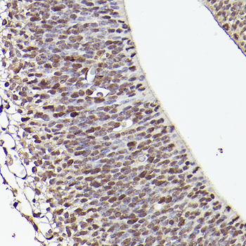 TET1 Rabbit pAb
