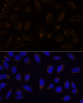 CD133 Rabbit pAb