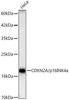 [KO Validated] CDKN2A/p16INK4a Rabbit pAb