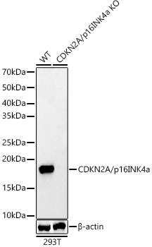 [KO Validated] CDKN2A/p16INK4a Rabbit pAb