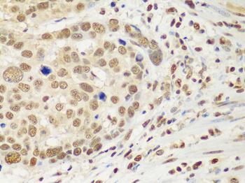HDAC2 Rabbit pAb