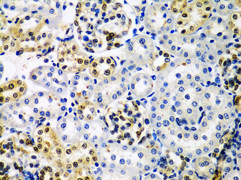 HDAC2 Rabbit pAb