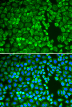 [KO Validated] Insulin-degrading enzyme (IDE) Rabbit pAb